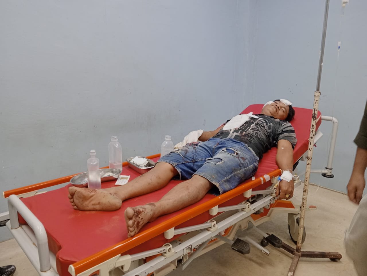 Dua Warga Tapteng Berkelahi Karena Pilkada, Satu Kena Bacok