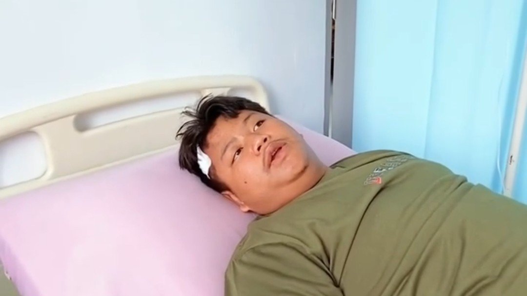 Pelajar SMAN 5 Binjai Jadi Korban Begal Sadis, Tangan Nyaris Putus Disabet Parang Saat Berangkat Sekolah
