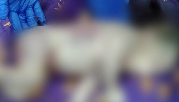 Warga Temukan Bayi Luka-luka di Semak Belukar, Nyawanya Tak Tertolong