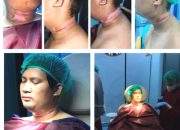 Kasus Luthfi Korban Jerat Kabel Menjuntai Akhirnya Dilanjutkan Polisi