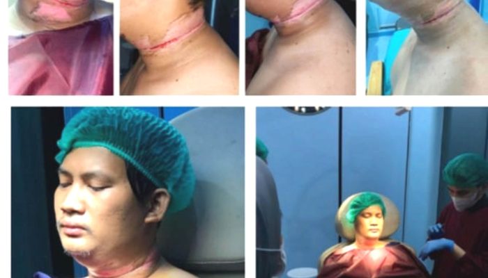 Lutfhi warga Medan Korban Kabel Semrawut Mencari Keadilan, Kini Lapor Polisi