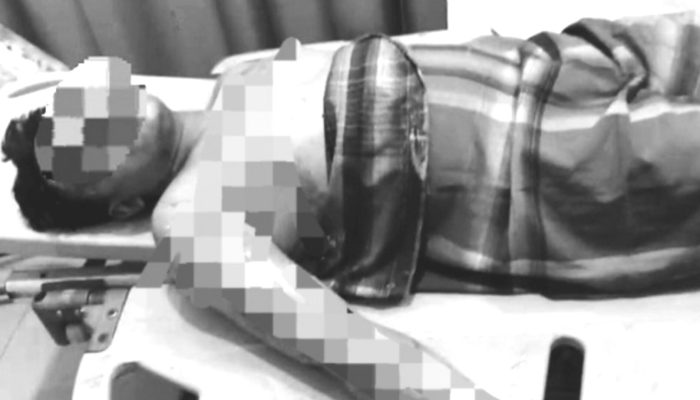 Pengurus Pesantren di Langkat Dibakar Santri, Alami Luka Bakar Hingga 80 Persen