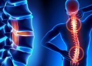 Saraf Kejepit, Yuk Kenali Gejala, Penyebab dan Pengobatannya