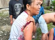 3 Warga Tapteng Jadi Korban Gigitan Anjing