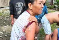 Ibu Jefri Gea, satu dari tiga orang yang menjadi korban gigitan anjing, Desa Kebun Pisang, Lorong 4 Lobu, Kecamatan Badiri, Kabupaten Tapanuli Tengah, Rabu (5/2). Foto: Istimewa