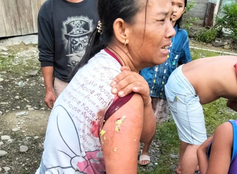 Ibu Jefri Gea, satu dari tiga orang yang menjadi korban gigitan anjing, Desa Kebun Pisang, Lorong 4 Lobu, Kecamatan Badiri, Kabupaten Tapanuli Tengah, Rabu (5/2). Foto: Istimewa