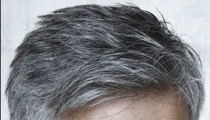 Uban di Usia Muda? Ketahui Penyebabnya dan Apa yang Bisa Kamu Lakukan!