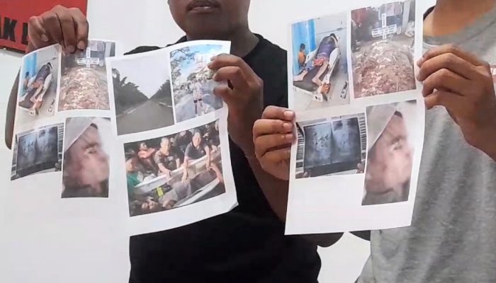 Pelajar di Asahan Diduga Dianiaya Oknum Polisi, Begini Hasil Investigasi Kontras Sumut