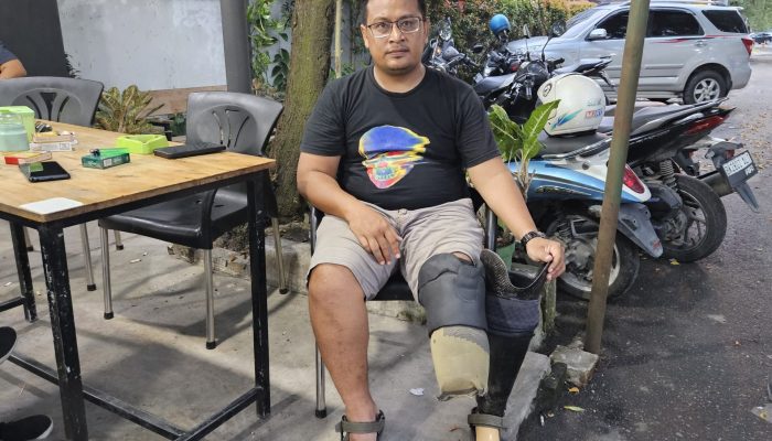 Dari Kurir JNT Jadi Korban: Dimas Kehilangan Kaki, Pekerjaan, dan Keadilan