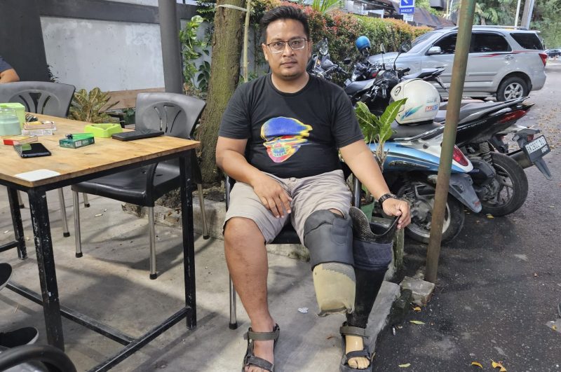 Dimas Tri Setyo (37), kurir JNT Pancurbatu, yang dipecat sepihak saat memperlihatkan kaki palsunya akibat kecelakaan. Foto: Dok.Pribadi