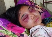 Siswi SMA Medan Disekap dan Dianiaya Pria yang Baru Dikenal dari Facebook