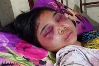 Suci Yolanda Ganda (17), siswi kelas III SMA di Kota Medan, menjadi korban penganiayaan