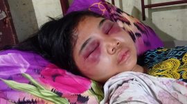 Suci Yolanda Ganda (17), siswi kelas III SMA di Kota Medan, menjadi korban penganiayaan