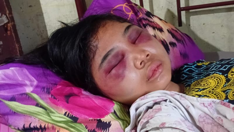 Suci Yolanda Ganda (17), siswi kelas III SMA di Kota Medan, menjadi korban penganiayaan