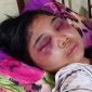 Suci Yolanda Ganda (17), siswi kelas III SMA di Kota Medan, menjadi korban penganiayaan