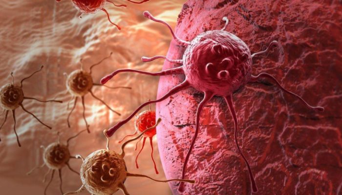 Pakar China Beber 6 Pilar Penting Penanganan Kanker: Pasien Bisa Hidup Lebih Panjang