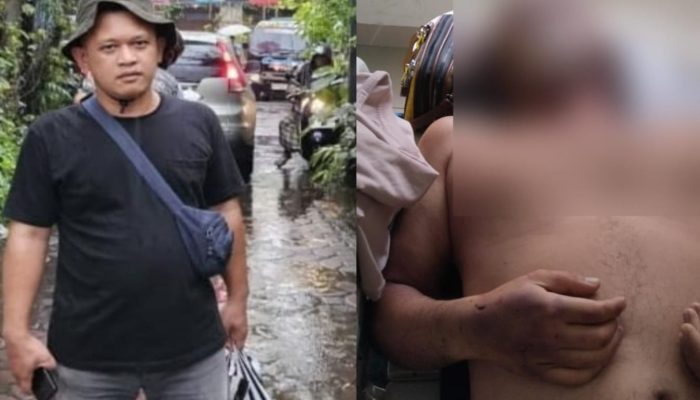 Kematian Jurnalis Medan Nico Saragih, LBH Medan Desak Polisi Ungkap Penyebabnya