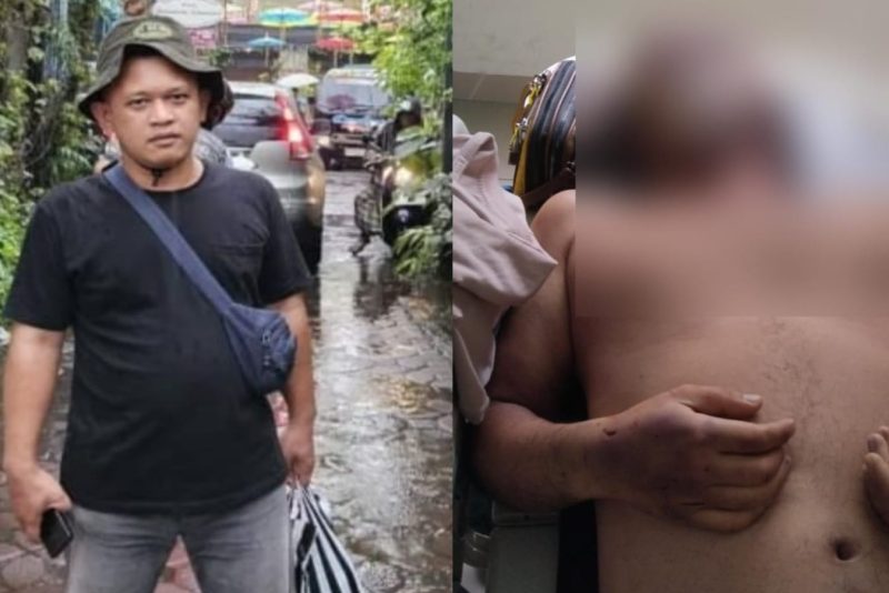 Wartawan Nico Saragih semasa hidup dan kondisi meninggal saat di rumah sakit. (Kolase)