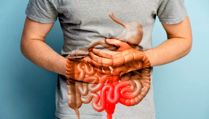 Waspada Penyakit Radang Usus, Dokter UI Beberkan Cara Mencegah dan Mengobatinya