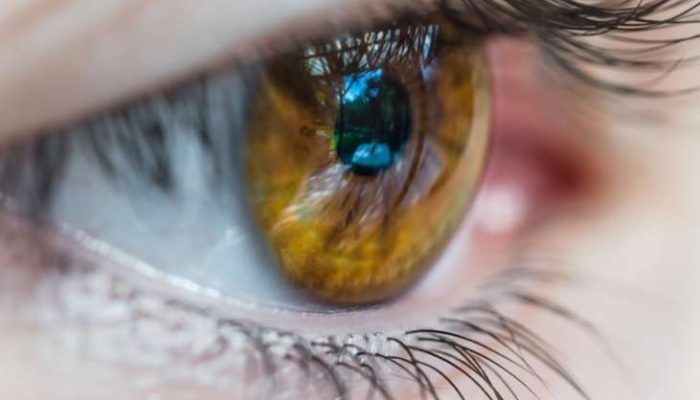 Mata Sering Berkedip Tanda Cacingan? Dokter UI Beber Fakta Sesungguhnya