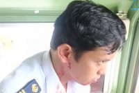 Seorang masinis jadi korban pelemparan KA di Kabupaten Asahan. Foto: Dok.Humas KAI Sumut