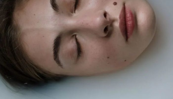 Mahasiswa UMY Kembangkan Alat AI “Scanoma” untuk Deteksi Dini Kanker Kulit, Akurasi Capai 75,22%