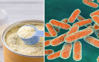 Ilustrasi bakteri Bacillus cereus penyebab kontaminasi pada produk pangan dan susu formula bayi berdasarkan hasil uji laboratorium.