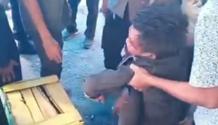 Residivis di Medan Siram Juru Parkir dengan Air Panas Saat Tidur, Korban Luka Melepuh