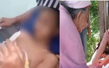 Viral Kasus Santri Dibakar di Lombok Tengah, Polisi Mulai Selidiki Dugaan Kekerasan Ponpes